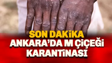 Son dakika: Türkiye'de Maymun Çiçeği şüphesi: 4 kişi karantinaya alındı