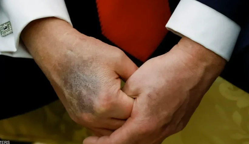 Trump'ın bu görüntüsü tüm dünyayı şaşırttı: 6 gündür ortalıkta yoktu