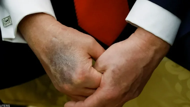 Trump'ın bu görüntüsü tüm dünyayı şaşırttı: 6 gündür ortalıkta yoktu